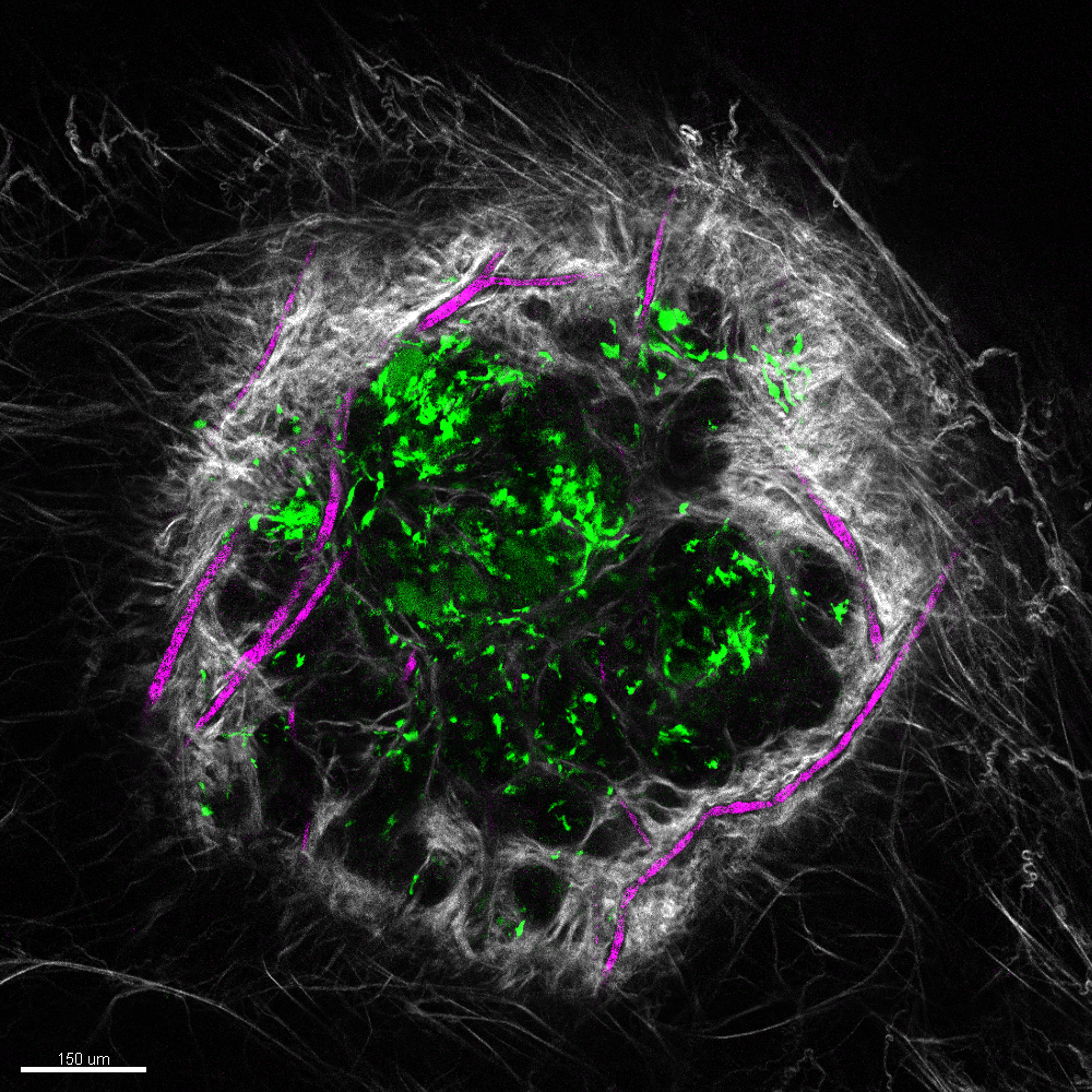 Vascularized wound under the microscope. 